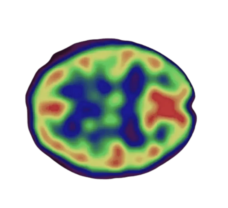 Brain scan visualization